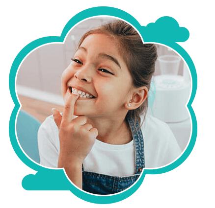 Pit-and-Fissure-Sealants